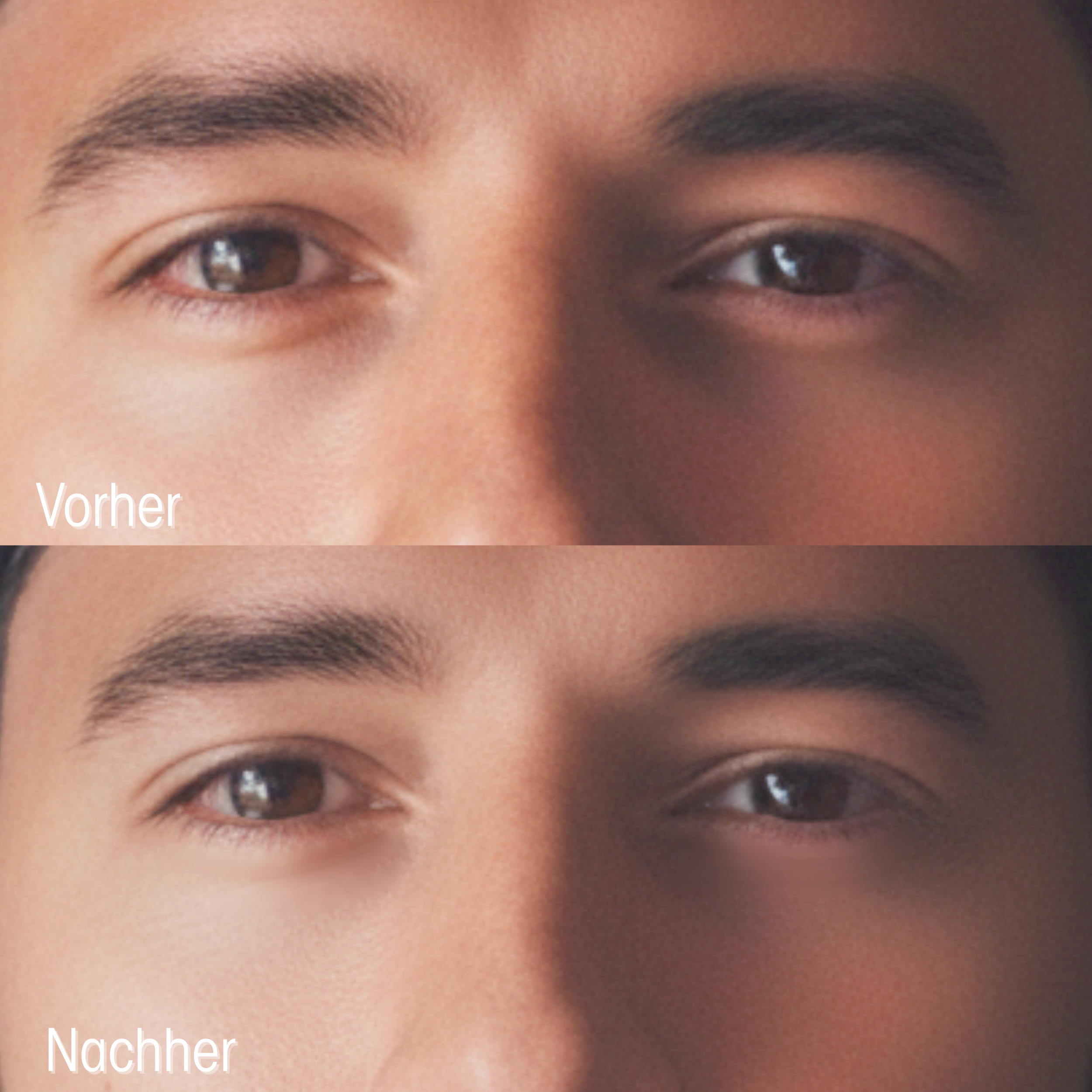 Peptide & Black Pearl Hydrogel Augenpads